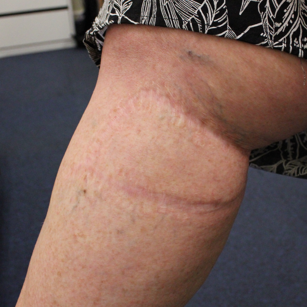 TDHS The Shark Bite Janice Lindsay